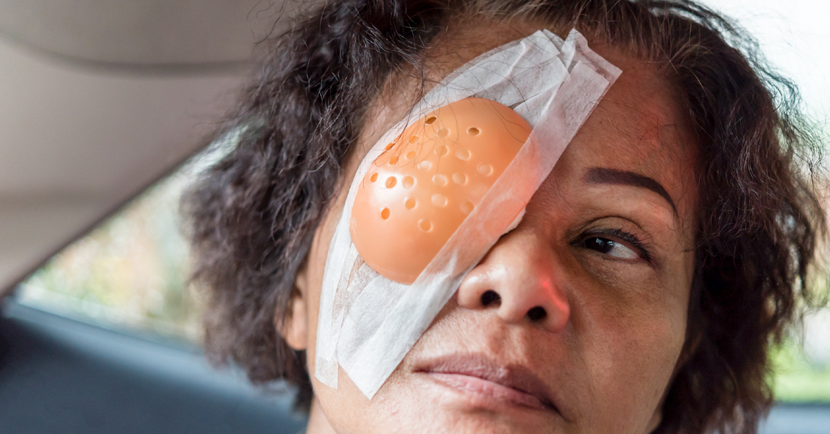 Risks and benefits of undergoing a cataract surgery
